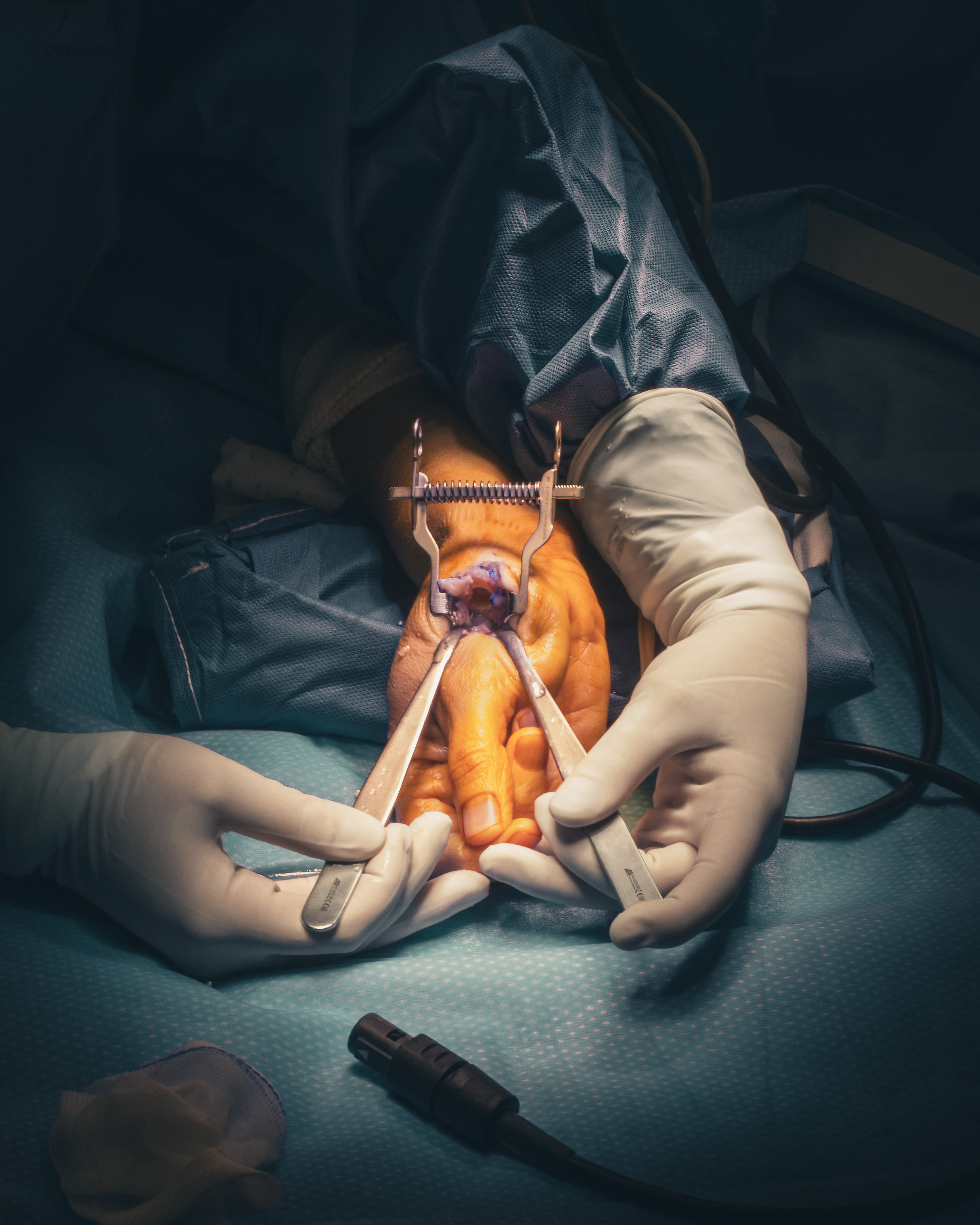 3 months in a surgery room.